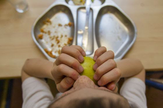 DESNUTRICION INFANTIL